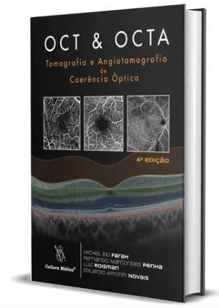 Oct & Octa: Tomografia E Angiotomografia De Coerência Óptica