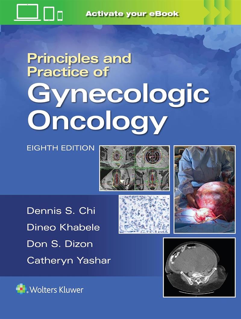 Principles And Practice Of Gynecologic Oncology