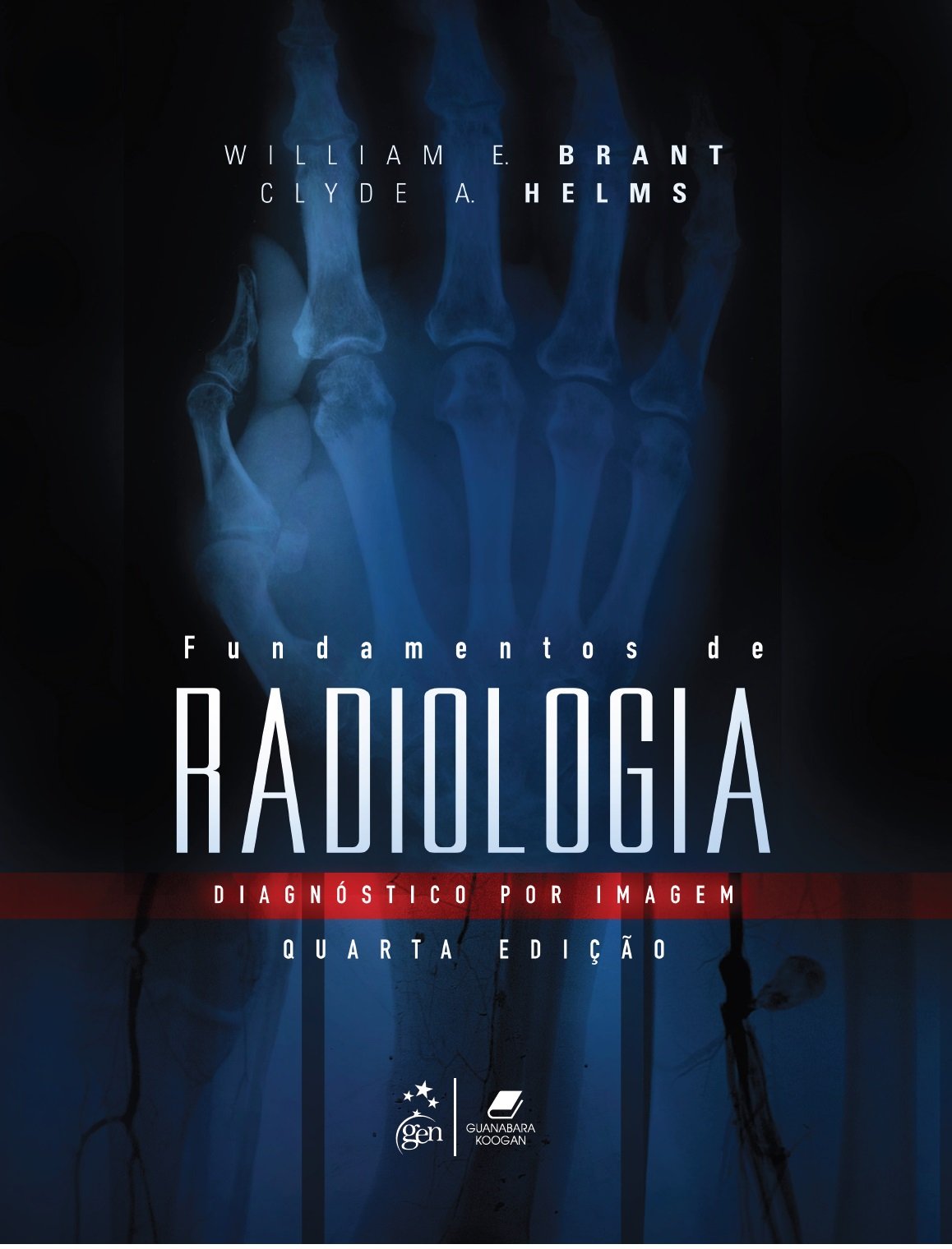 Fundamentos De Radiologia Diagnóstico Por Imagem 9788527726276 Di Livros Editora E Livraria 6924
