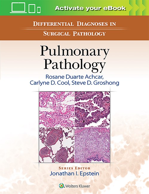 Livro - Differential Diagnosis In Surgical Pathology: Pulmonary ...