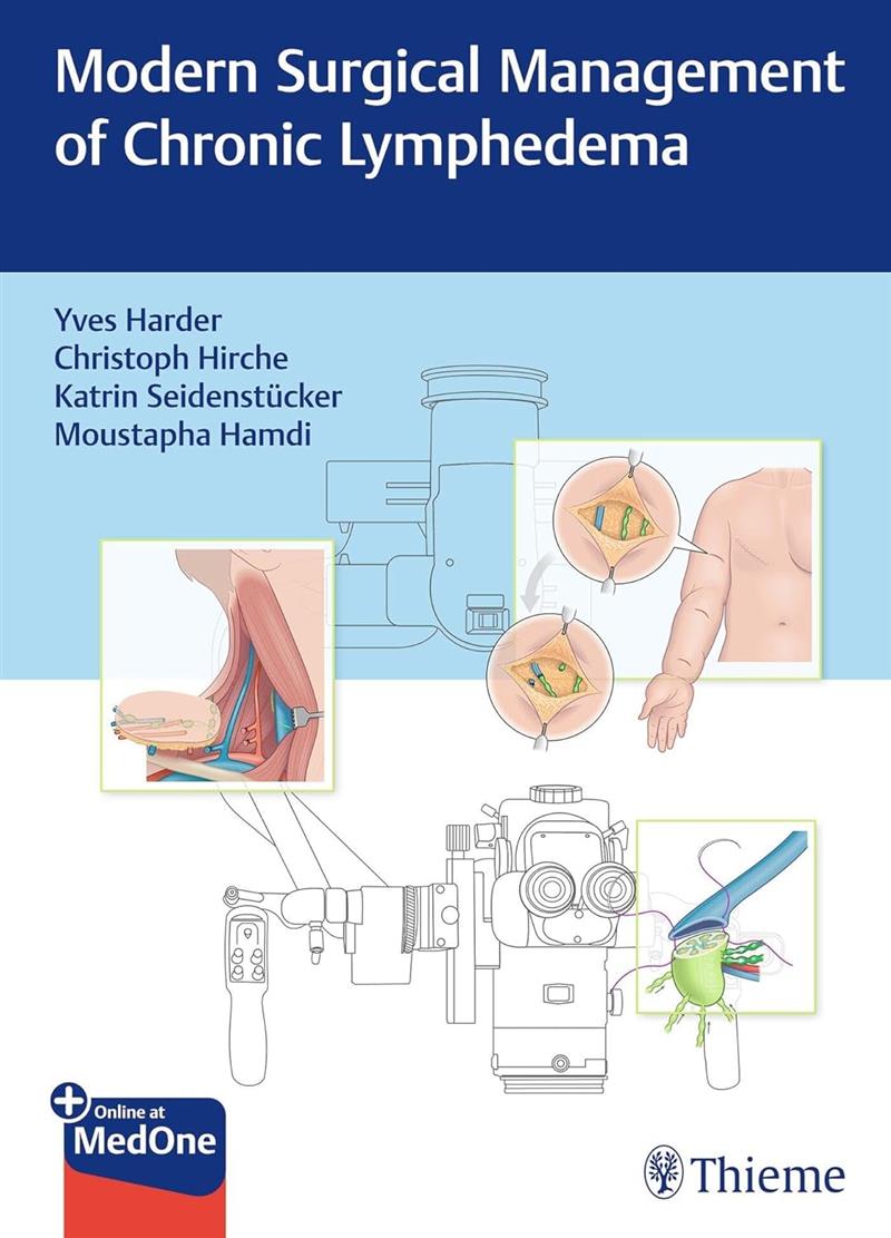 Modern Surgical Management Of Chronic