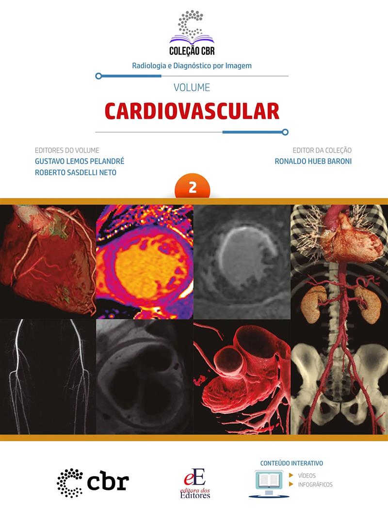 Coleção Cbr Volume 2: Cardiovascular