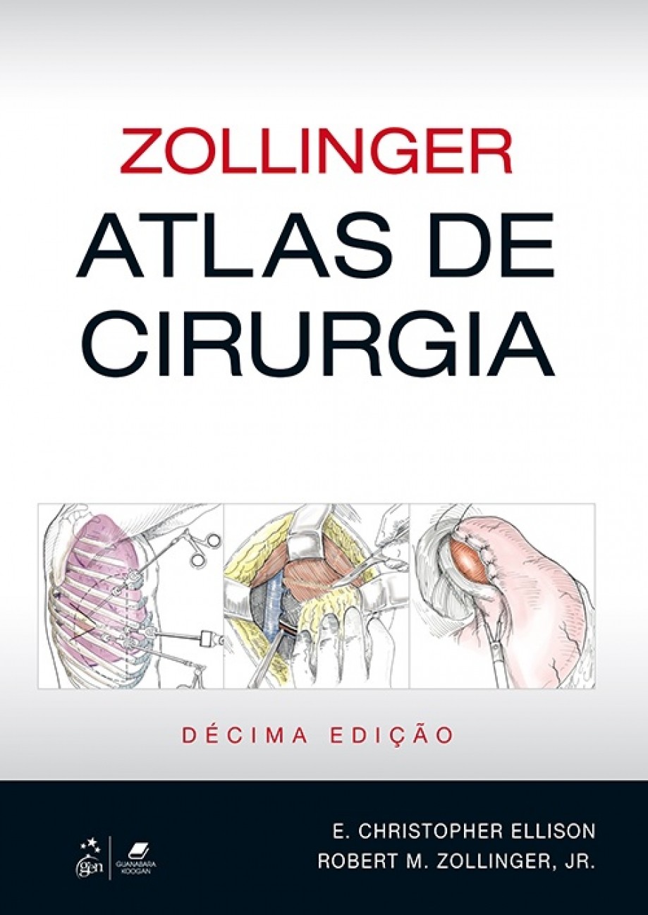atlas de cirugia zollinger pdf