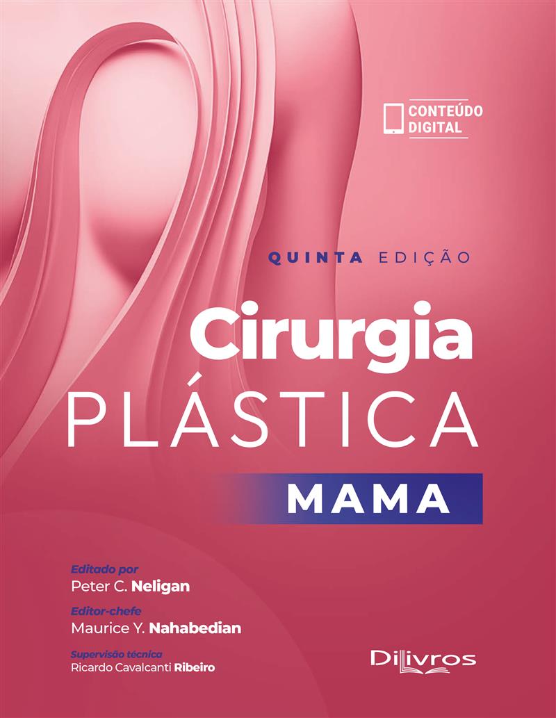 Mama Cirurgia Plastica