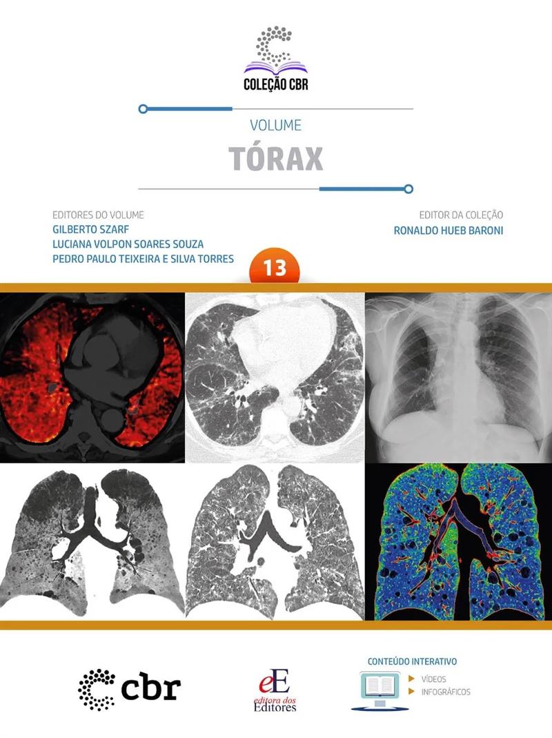 Coleção Cbr Volume 13: Tórax