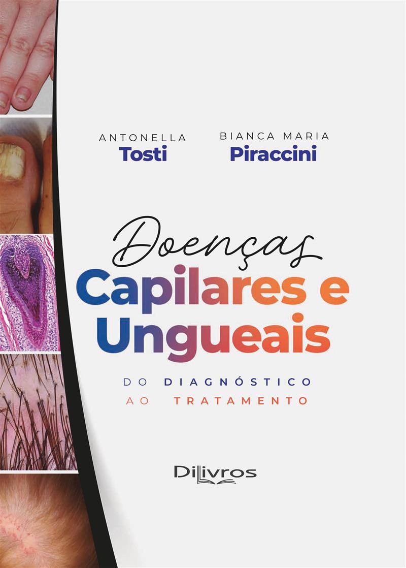 Doencas Capilares E Ungueais