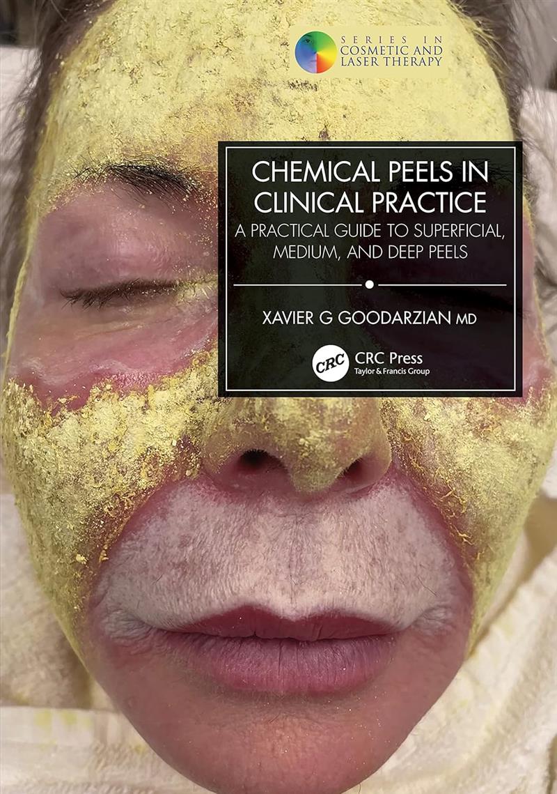 Chemical Peels In Clinical Practice (brochura)