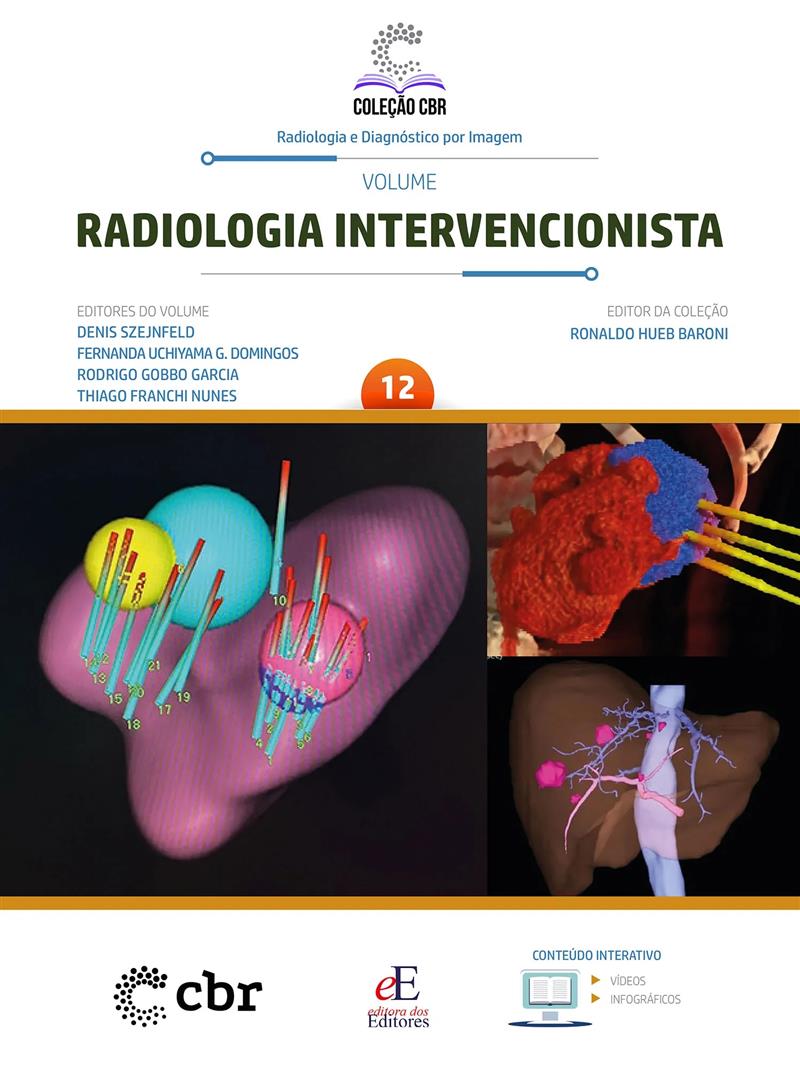 Coleção Cbr Volume 12: Radiologia Intervencionista