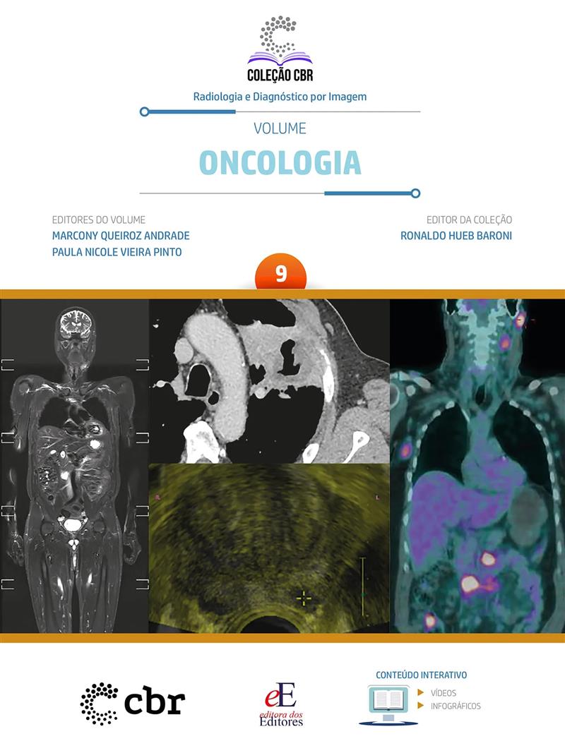 Coleção Cbr Volume 9: Oncologia