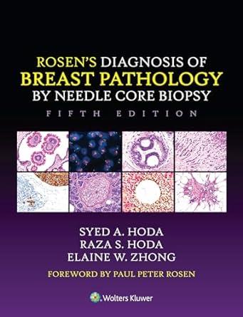 Rosen Diagnosis Of Breast Pathology By Needle Core Biopsy