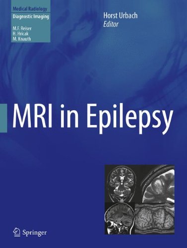 Mri In Epilepsy