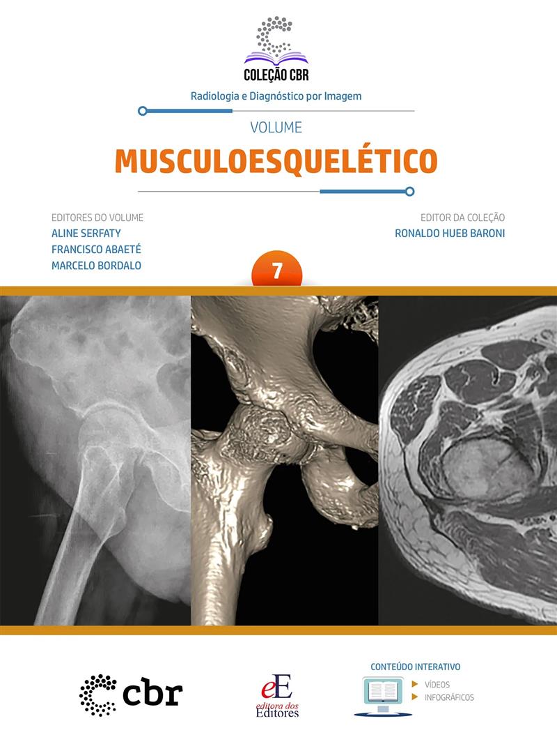 Coleção Cbr Volume 7: Musculoesquelético