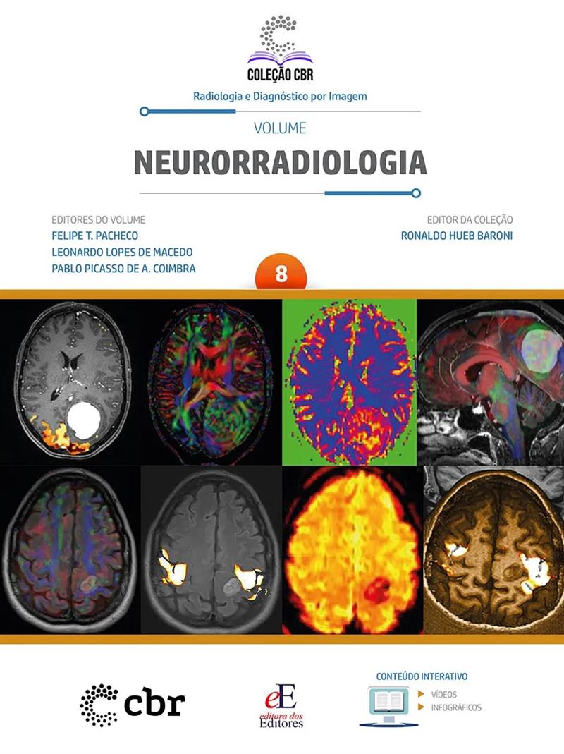 Coleção Cbr Volume 8: Neurorradiologia