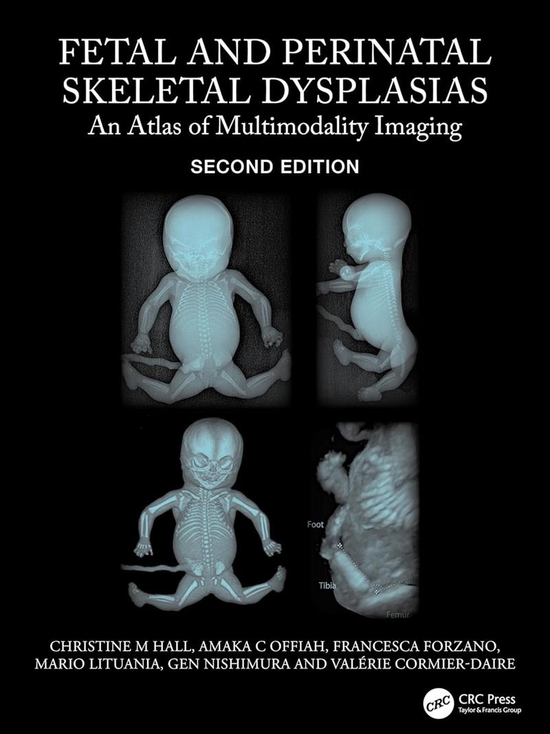 Fetal And Perinatal Skeletal Dysplasias