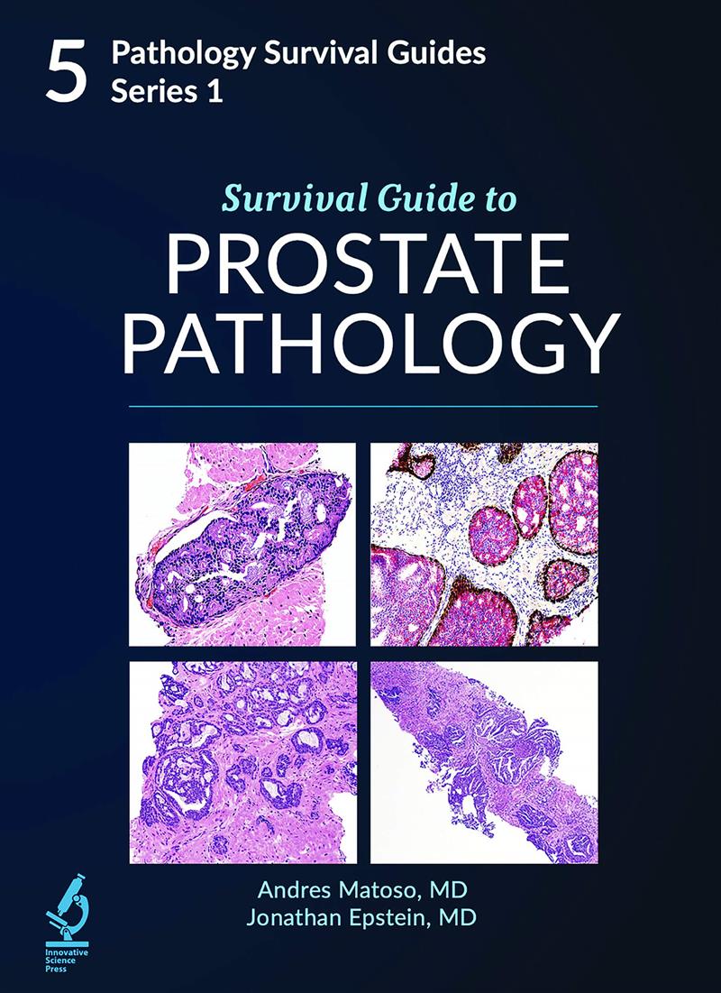 Survival Guide To Prostate Pathology