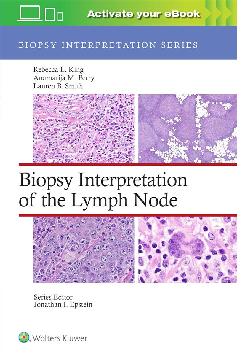 Biopsy Interpretation Of The Lymph Node