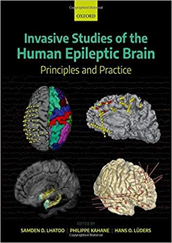 Invasive Studies Of The Human Epileptic Brain