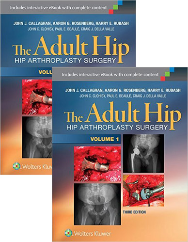 THE ADULT HIP: ARTHROPLASTY AND ITS ALTERNATIVES, 9781451183696 
