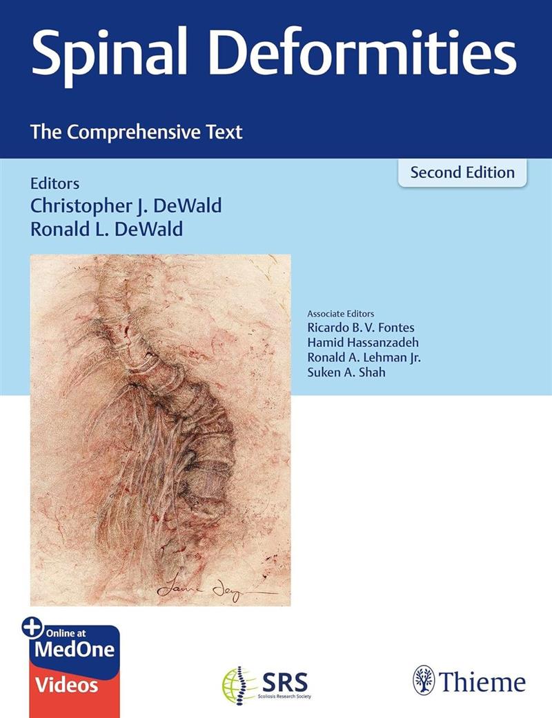 Spinal Deformities The Comprehensive Text