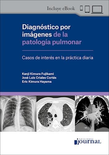 Diagnostico Por Imagenes De La Patologia Pulmonar
