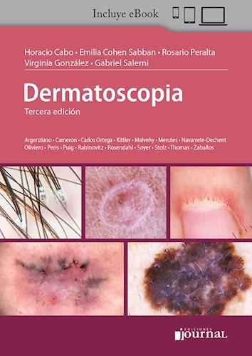Dermatoscopia  (espanhol)
