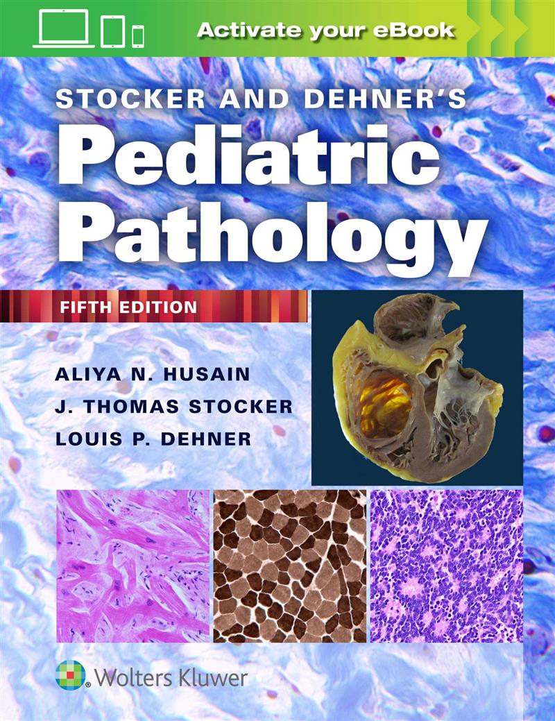 Stocker And Dehner S Pediatric Pathology