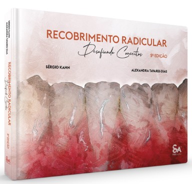 Recobrimento Radicular: Desafiando Conceitos