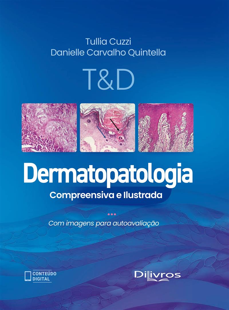 T & D Dermatopatologia Compreensiva Ilustrada