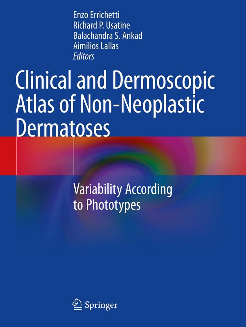 Clinical And Dermoscopic Atlas Of Non Neoplastic Dermatoses