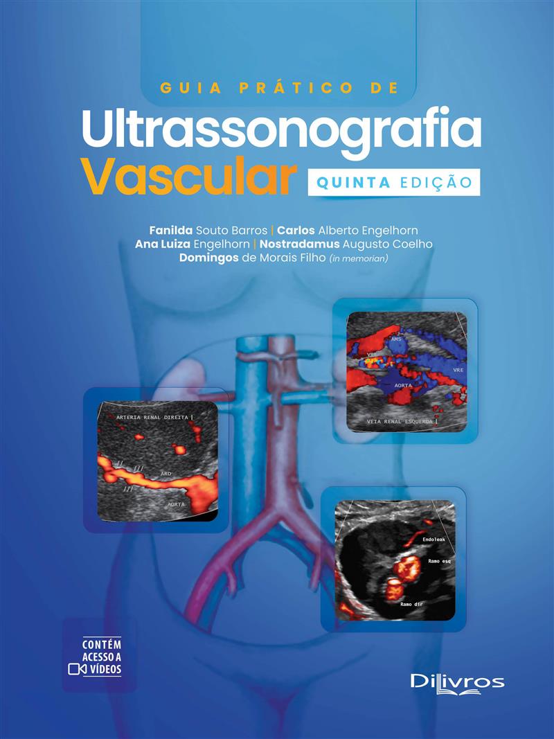 Guia Prático De Ultrassonografia Vascular