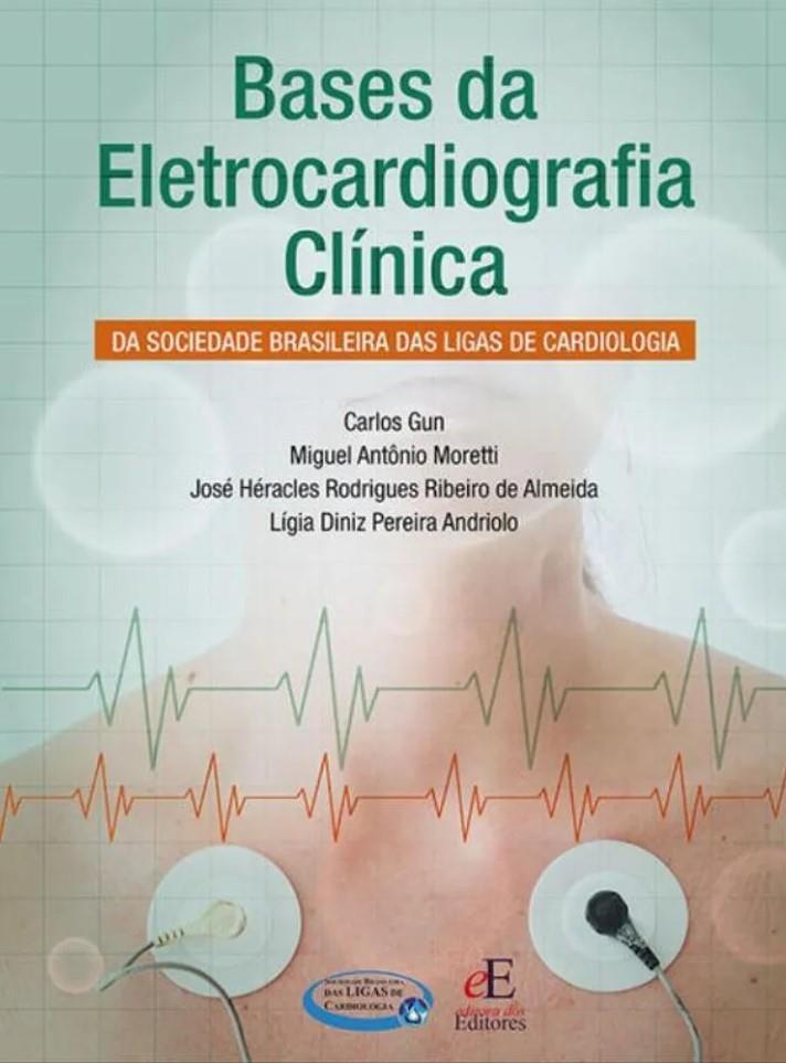 Bases Da Eletrocardiografia Clinica