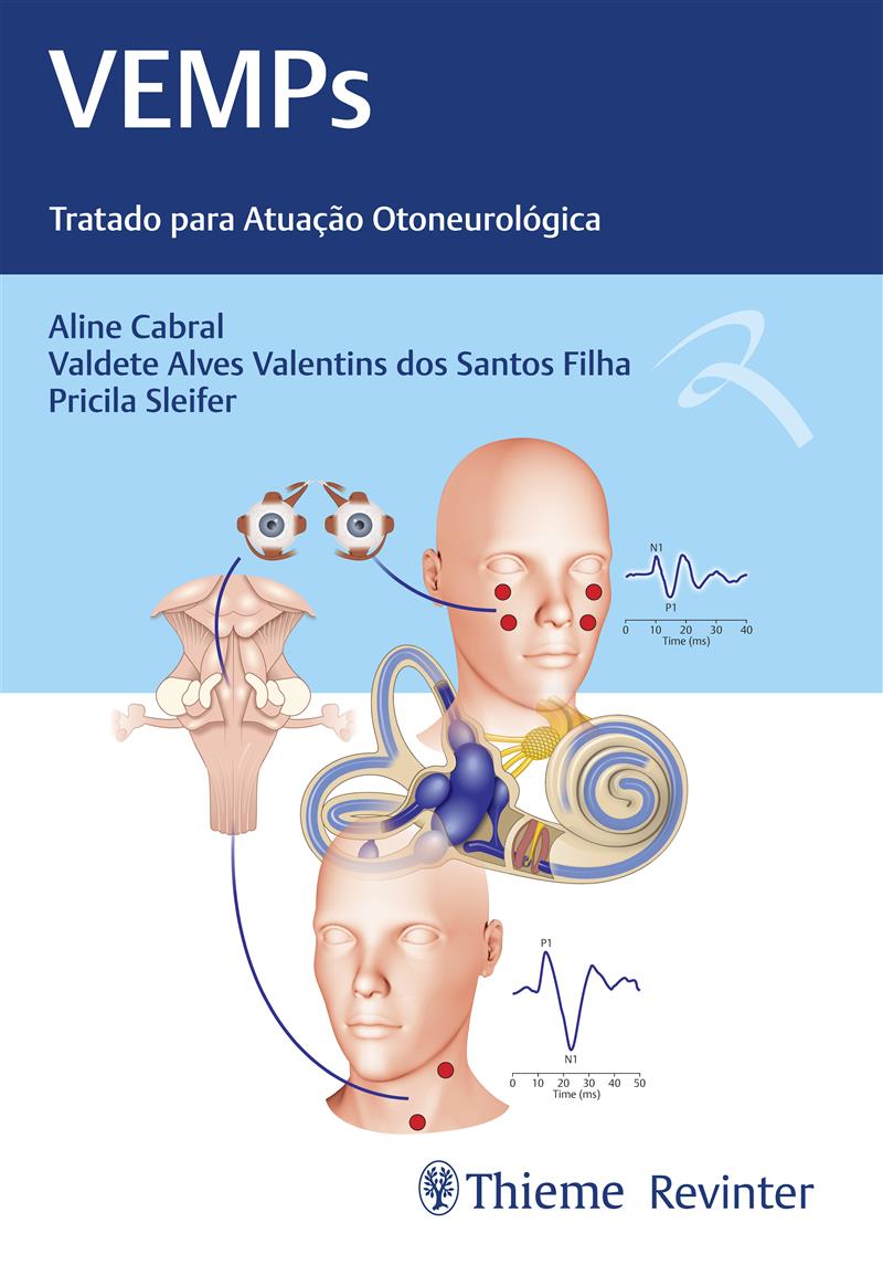 Vemps: Tratado Para Atuação Otoneurológica